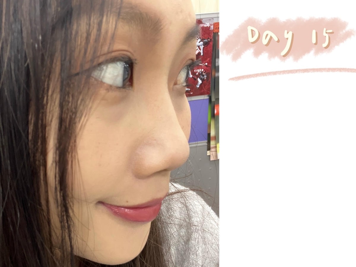 S__39755873.jpg S__39755873.jpg