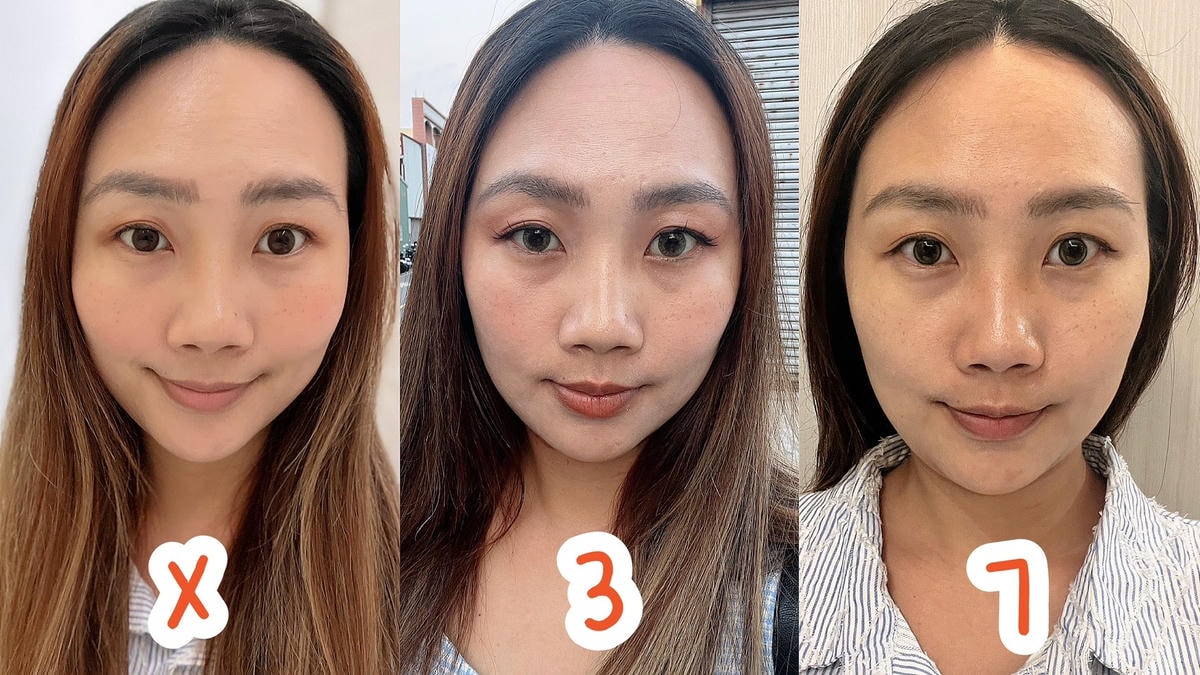 [ 醫美分享 ] 恆美學信義診所 來自韓國的歐巴醫師鄒承軒,