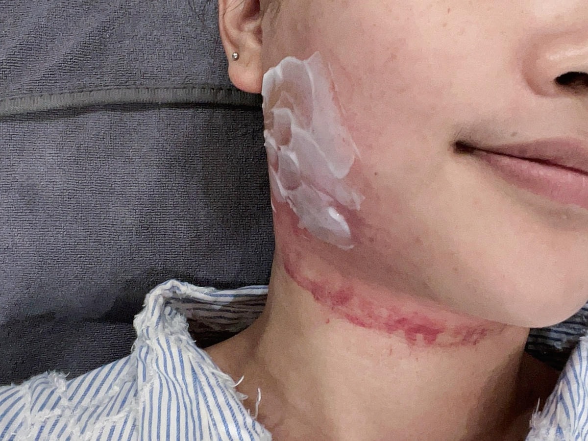 [ 醫美分享 ] 恆美學信義診所 來自韓國的歐巴醫師鄒承軒,