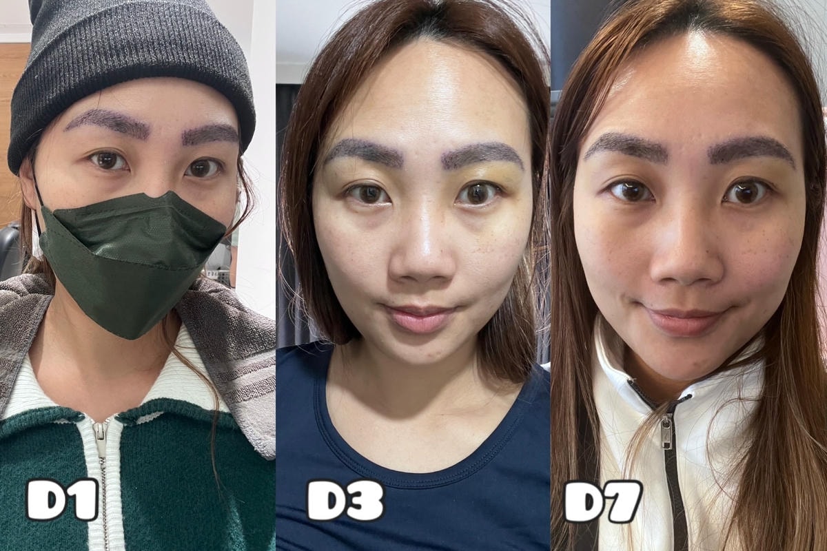 [植眉推薦]DCDC生髮診所朱冠州醫師眉毛稀疏救星!第三代