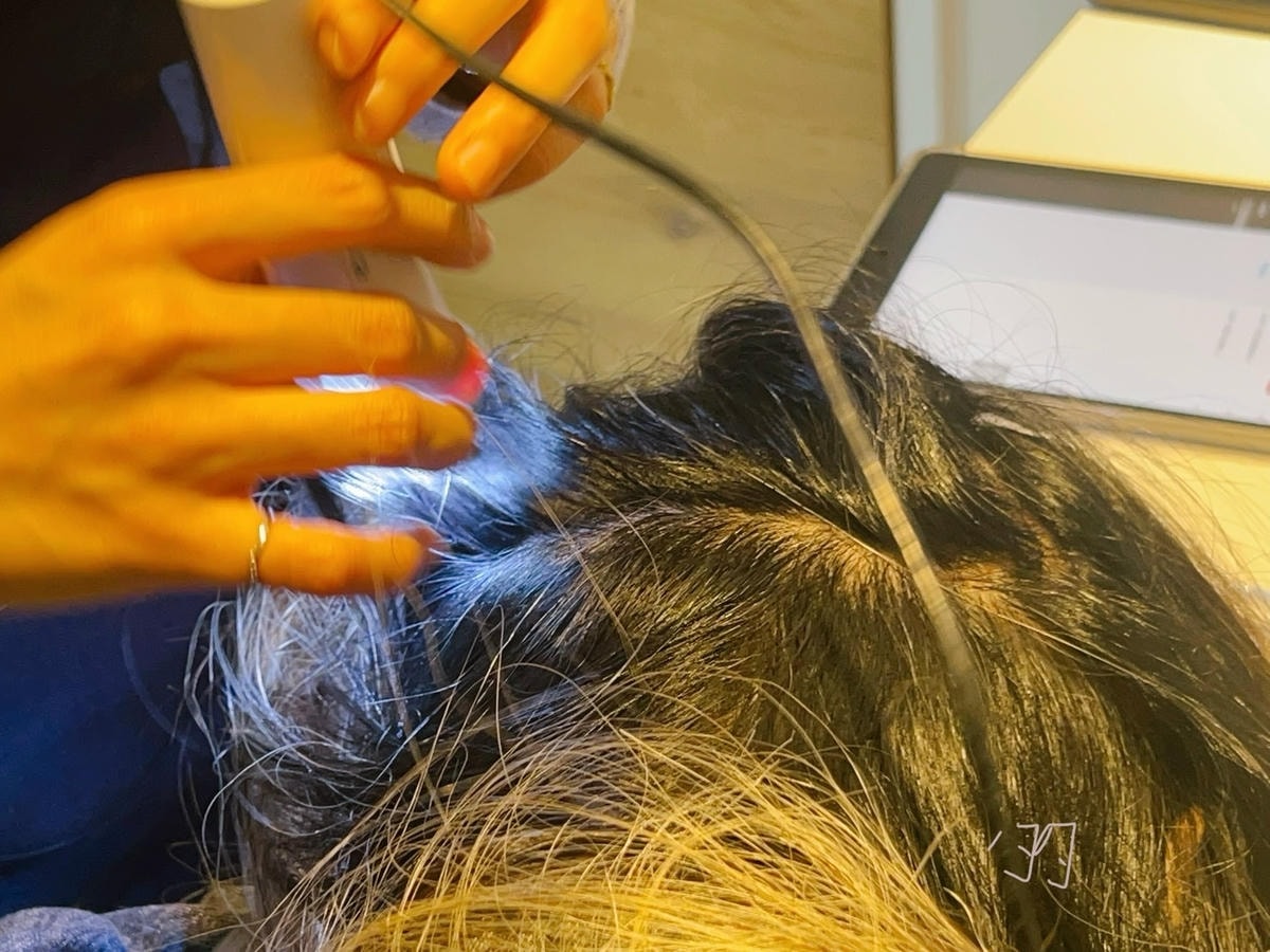 [植眉推薦]DCDC生髮診所朱冠州醫師眉毛稀疏救星!第三代