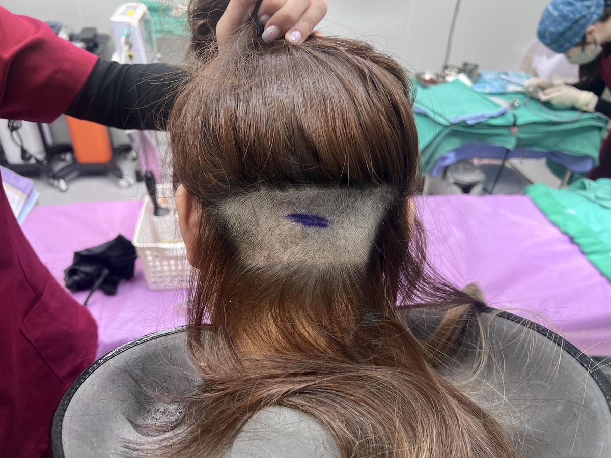 [植眉推薦]DCDC生髮診所朱冠州醫師眉毛稀疏救星!第三代